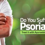 Ayurvedic Remedies for Psoriasis