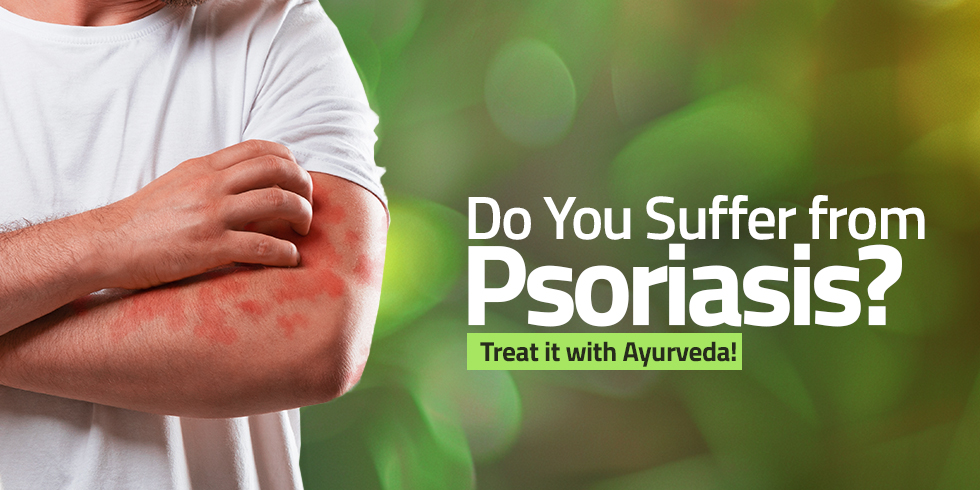 Effective Ayurvedic Remedies for Psoriasis