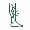 Varicose-Veins